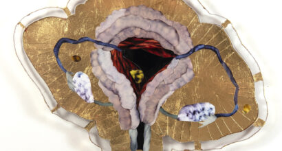 An artist's interpretation of a uterus. The main colour is gold.