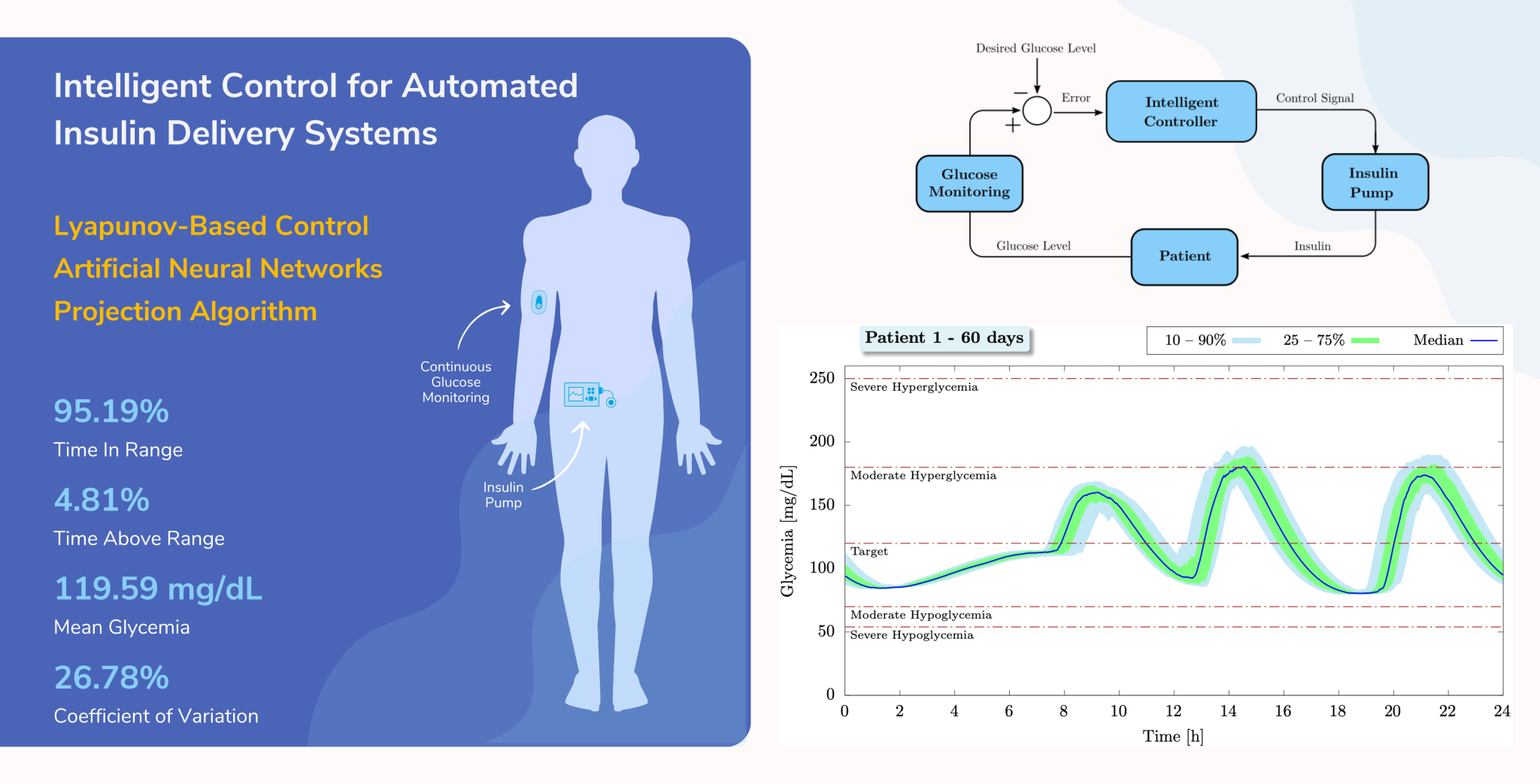 Intelligent Control for Automated Insulin Delivery Systems Smart Systems